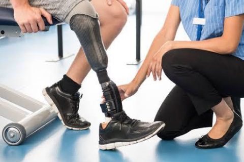 Prosthesis Services